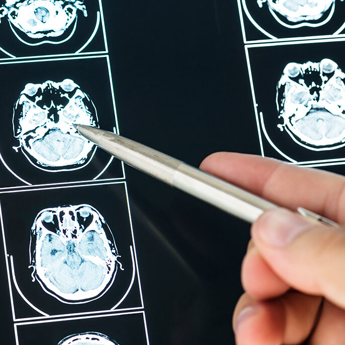 Closeup of brain mri scan result Closeup of brain mri scan result