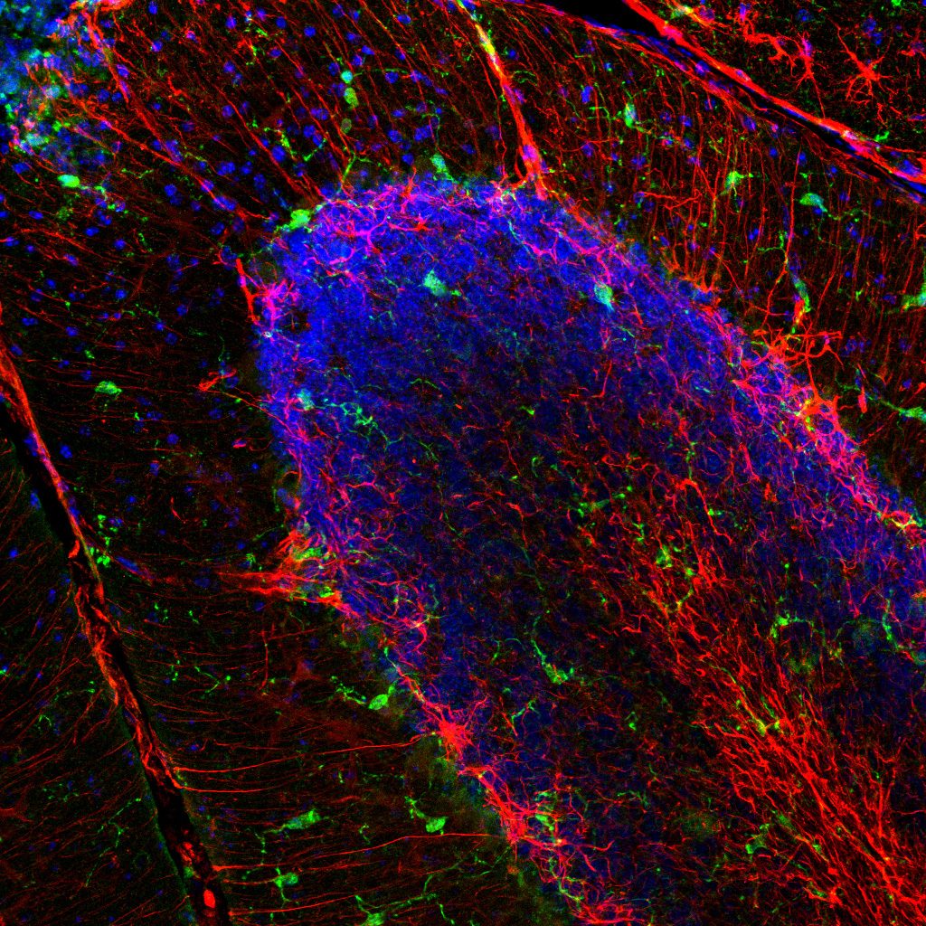 Influx of inflammmatory biomarkers (green, red) in the brain cerebellum in response to neuronal injury