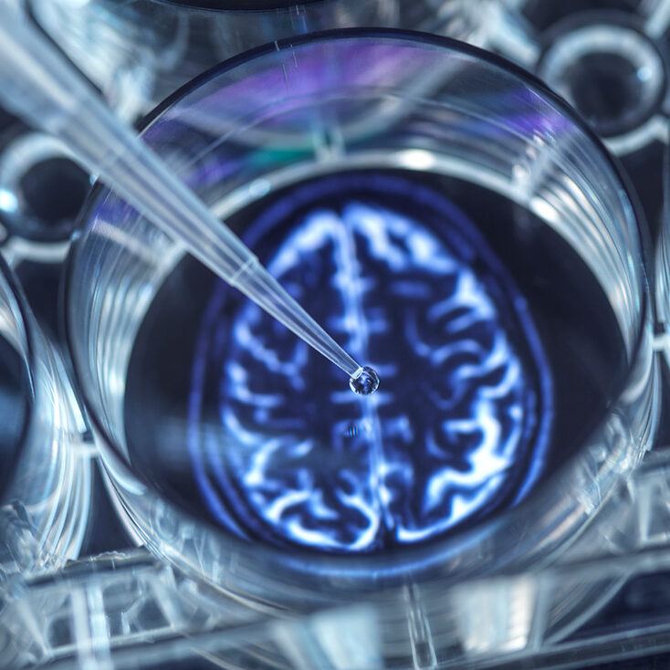 pipetting-solution-and-brain-scan Pipette dropping a solution into a container with the image of a brain underneath